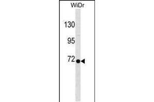 Western blot analysis in WiDr cell line lysates (35ug/lane). (RPN1 Antikörper  (C-Term))