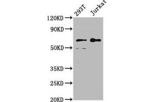 Western Blot Positive WB detected in: 293T whole cell lysate, Jurkat whole cell lysate All lanes: LILRB2 antibody at 4 μg/mL Secondary Goat polyclonal to rabbit IgG at 1/50000 dilution Predicted band size: 66, 65, 56, 52 kDa Observed band size: 66 kDa (LILRB2 Antikörper  (AA 406-563))