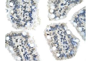 GIPC2 antibody was used for immunohistochemistry at a concentration of 4-8 ug/ml to stain Epithelial cells of intestinal villus (arrows) in Human Intestine. (GIPC2 Antikörper  (N-Term))