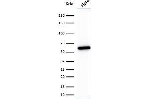 Western Blot analysis of HeLa cell lysate using HSP60-Monospecific Mouse Monoclonal Antibody (HSPD1/780) (HSPD1 Antikörper)