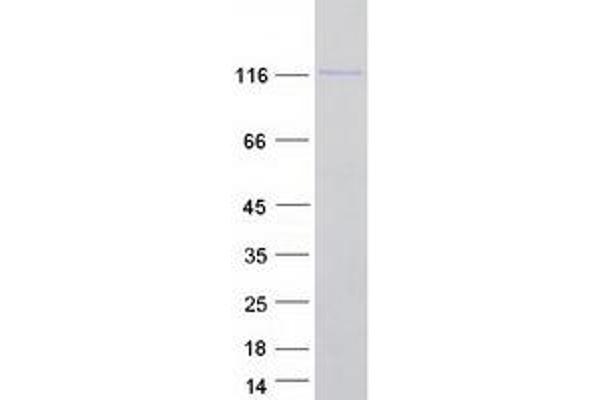 HNRNPU Protein (Transcript Variant 2) (Myc-DYKDDDDK Tag)