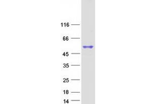 SP6 Protein (Myc-DYKDDDDK Tag)