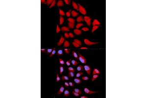 Immunofluorescence analysis of U2OS cells using PSMA6 antibody. (PSMA6 Antikörper)