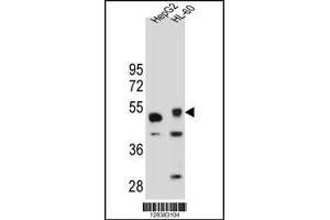 Western blot analysis in HepG2 and HL-60 cell line lysates (35ug/lane). (TIGD3 Antikörper  (C-Term))