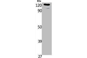 Western Blot analysis of K562, cells using Phospho-Ob-R (Y1141) Polyclonal Antibody (Leptin Receptor Antikörper  (pTyr1141))