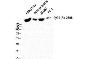 Western Blot analysis of HepG2-UV Mouse-BRAIN AD293 PC-3 cells using RyR-2 Polyclonal Antibody diluted at 1:2000. (RYR2 Antikörper)