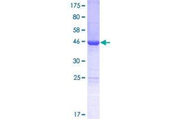 LSM12B Protein (AA 1-195) (GST tag)