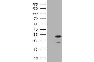 Image no. 2 for anti-Membrane-Spanning 4-Domains, Subfamily A, Member 1 (MS4A1) antibody (ABIN1497207) (CD20 Antikörper)