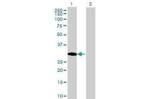 Lane 1: LYSMD2 transfected lysate ( 23. (LYSMD2 293T Cell Transient Overexpression Lysate(Denatured))