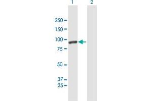 Western Blot analysis of CALD1 expression in transfected 293T cell line by CALD1 MaxPab polyclonal antibody. (Caldesmon Antikörper  (AA 1-538))