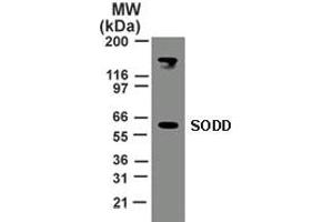 Image no. 1 for anti-BCL2-Associated Athanogene 4 (BAG4) (AA 443-457) antibody (ABIN199970) (BAG4 Antikörper  (AA 443-457))