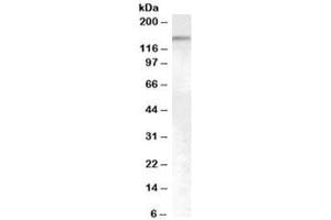 Western blot testing of HeLa cell nuclear lysate with SENP6 antibody at 0. (SENP6 Antikörper)