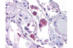 KITLG antibody was used for immunohistochemistry at a concentration of 4-8 ug/ml. (KIT Ligand Antikörper  (Middle Region))