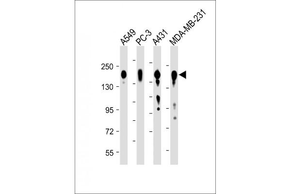 EGFR Antikörper  (C-Term)