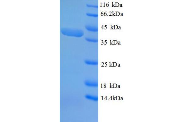 SPEG Protein (AA 1-113, partial) (GST tag)