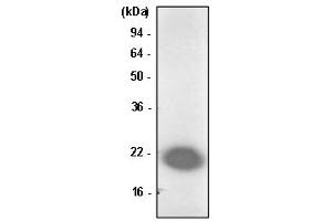 Western Blotting (WB) image for anti-Parkinson Protein 7 (PARK7) antibody (ABIN361043) (PARK7/DJ1 Antikörper)