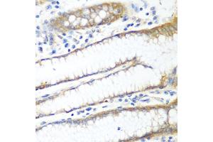 Immunohistochemistry of paraffin-embedded human stomach using PPP4R1 antibody (ABIN5974671) at dilution of 1/100 (40x lens). (PPP4R1 Antikörper)