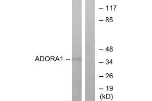 Western blot analysis of extracts from MCF-7 cells, using ADORA1 antibody. (ADORA1 Antikörper  (C-Term))