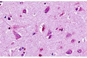 Human, Brain, neurons: Formalin-Fixed Paraffin-Embedded (FFPE) (LGR5 Antikörper  (Cytoplasmic Domain))