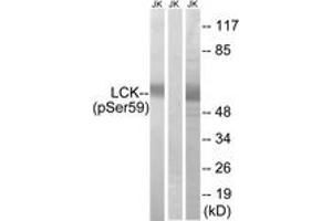 Western blot analysis of extracts from Jurkat cells treated with IFN 2500U/ML 30', using LCK (Phospho-Ser59) Antibody. (LCK Antikörper  (pSer59))