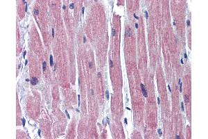 Anti-TNNI3 / CTnI antibody IHC of human heart. (TNNI3 Antikörper  (C-Term))