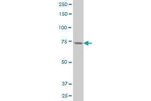 PRKCH polyclonal antibody (A02), Lot # 051128JC01 Western Blot analysis of PRKCH expression in A-431 . (PKC eta Antikörper  (AA 1-100))