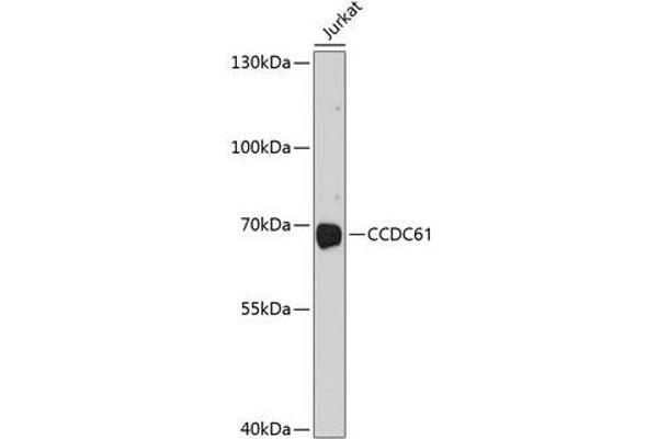 CCDC61 Antikörper