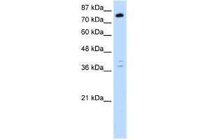 WB Suggested Anti-TSC22D2 Antibody Titration:  0. (TSC22D2 Antikörper  (C-Term))