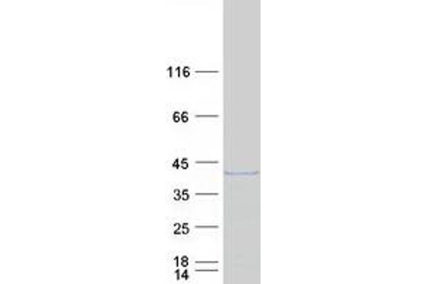 GEM Protein (Transcript Variant 2) (Myc-DYKDDDDK Tag)