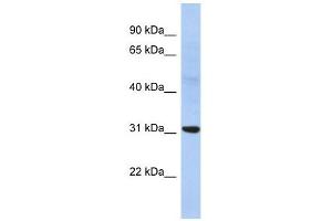 NP antibody used at 1 ug/ml to detect target protein. (NP (Middle Region) Antikörper)