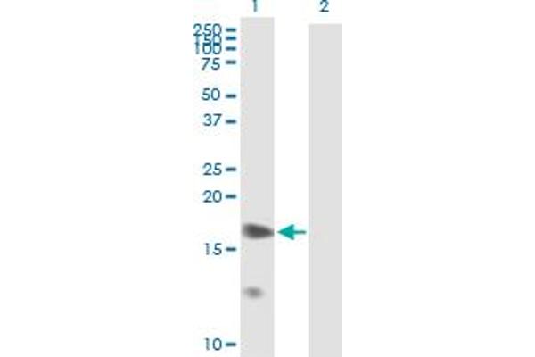 Prostaglandin E Synthase Antikörper  (AA 1-152)