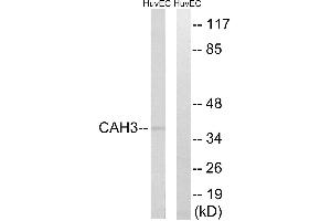 Western blot analysis of extracts from HUVEC cells, using CA3 antibody. (CA3 Antikörper)