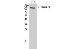 Western Blotting (WB) image for anti-PTK2 Protein tyrosine Kinase 2 (PTK2) (pTyr576) antibody (ABIN3179639) (FAK Antikörper  (pTyr576))