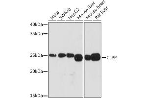 Western blot analysis of extracts of various cell lines, using CLPP Rabbit mAb (ABIN1682296, ABIN3017596, ABIN3017597 and ABIN7101508) at 1:1000 dilution. (CLPP Antikörper)