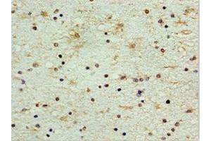 Immunohistochemistry of paraffin-embedded human brain tissue using ABIN7148846 at dilution of 1:100 (CDK1 Antikörper  (AA 1-283))