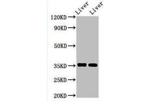 Western Blotting (WB) image for anti-Arginase, Liver (ARG1) (AA 1-322) antibody (ABIN6091458) (Liver Arginase Antikörper  (AA 1-322))