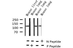 Western blot analysis of Phospho-HDAC5 (Ser498) expression in various lysates (HDAC5 Antikörper  (pSer498))