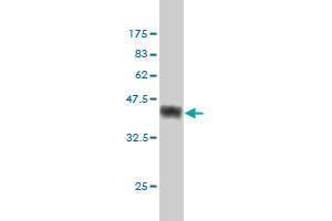 Western Blot detection against Immunogen (38. (PRKACA Antikörper  (AA 1-120))