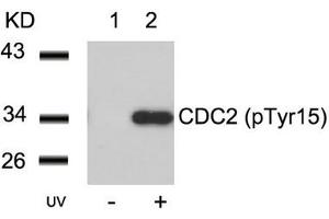 Western blot analysis of extracts from Hela cells untreated(lane 1) or treated with UV(lane 2) using CDC2(Phospho-Tyr15) Antibody. (CDK1 Antikörper  (pTyr15))