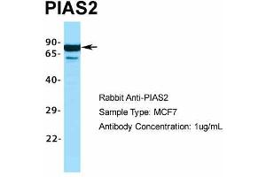 Host:  Rabbit  Target Name:  PIAS2  Sample Type:  MCF7  Antibody Dilution:  1. (PIAS2 Antikörper  (C-Term))