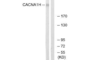 Western blot analysis of extracts from A549 cells, using CACNA1H antibody. (CACNA1H Antikörper  (Internal Region))