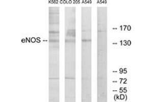 Western blot analysis of extracts from A549/K562/COLO205 cells, using eNOS (Ab-1179) Antibody. (ENOS Antikörper  (AA 1145-1194))