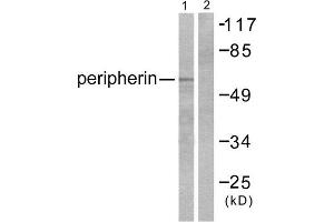 Western Blotting (WB) image for anti-Peripherin (PRPH) (C-Term) antibody (ABIN1848741) (Peripherin Antikörper  (C-Term))