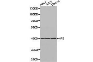 Western Blotting (WB) image for anti-Hemochromatosis (HFE) antibody (ABIN1872964) (HFE Antikörper)