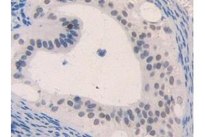 Used in DAB staining on fromalin fixed paraffin- embedded lung tissue (CCL4 Antikörper  (AA 24-92))