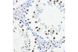 Immunohistochemistry of paraffin-embedded mouse testis using ZEB1 antibody (ABIN6129933, ABIN6150422, ABIN6150423 and ABIN6221237) at dilution of 1:200 (40x lens). (ZEB1 Antikörper  (AA 1-260))