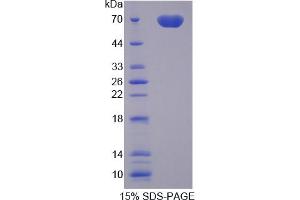 Image no. 1 for Milk Fat Globule-EGF Factor 8 Protein (MFGE8) (AA 73-421) protein (His tag,GST tag) (ABIN6237720) (MFGE8 Protein (AA 73-421) (His tag,GST tag))