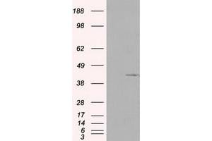 Western Blotting (WB) image for anti-Pleckstrin (PLEK) antibody (ABIN1500265) (Pleckstrin Antikörper)