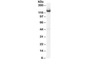 Western blot testing of mouse brain lysate with Amphiphysin antibody at 0. (Amphiphysin Antikörper)