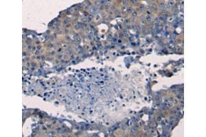 Immunohistochemistry (IHC) image for anti-Fibroblast Growth Factor 2 (Basic) (FGF2) antibody (ABIN2425615) (FGF2 Antikörper)